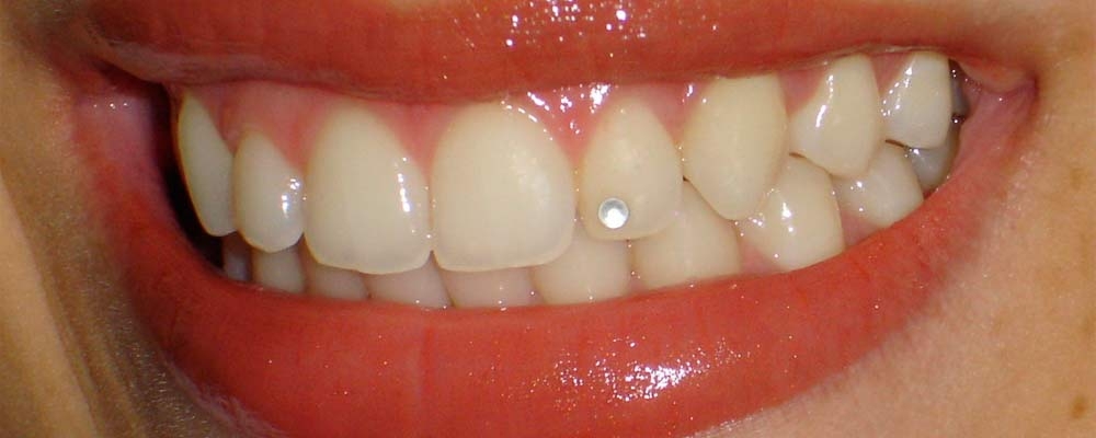 dental piercing2