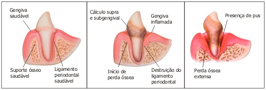 dperiodontal02