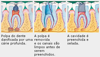 endodontia01