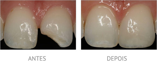 restauracoes esteticas
